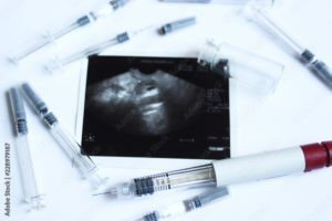 Syringes and ultrasound photo